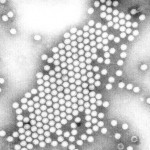Polio virus Polio virus